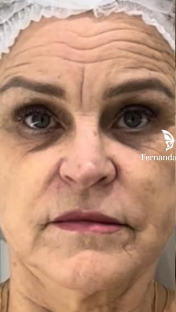 Antes do tratamento 2