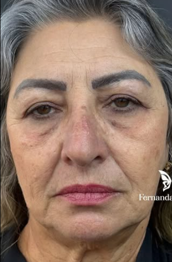 Antes do tratamento 3