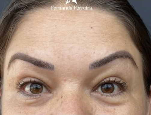 Depois do tratamento 1